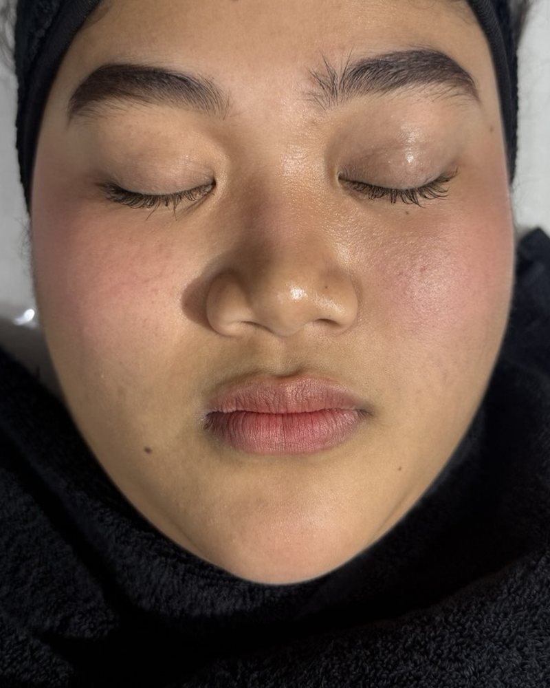 Before treatment